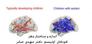 اندازه و ساختار مغز کودکان اوتیسم