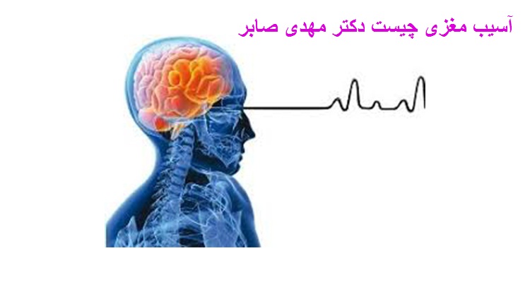 آسیب مغزی چیست