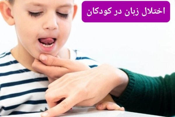 اختلال زبان در کودکان