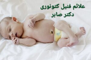 کاردرمانی فنیل کتونوری