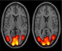 fmri مغز